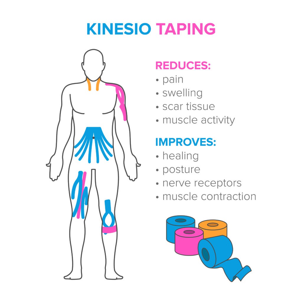functions of physio kinesiology tape functions of physio kinesiology tape