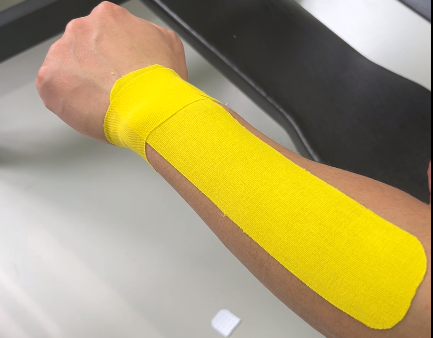 Kinesiology Tape For Carpal Tunnel Kinesiology Tape For Carpal Tunnel